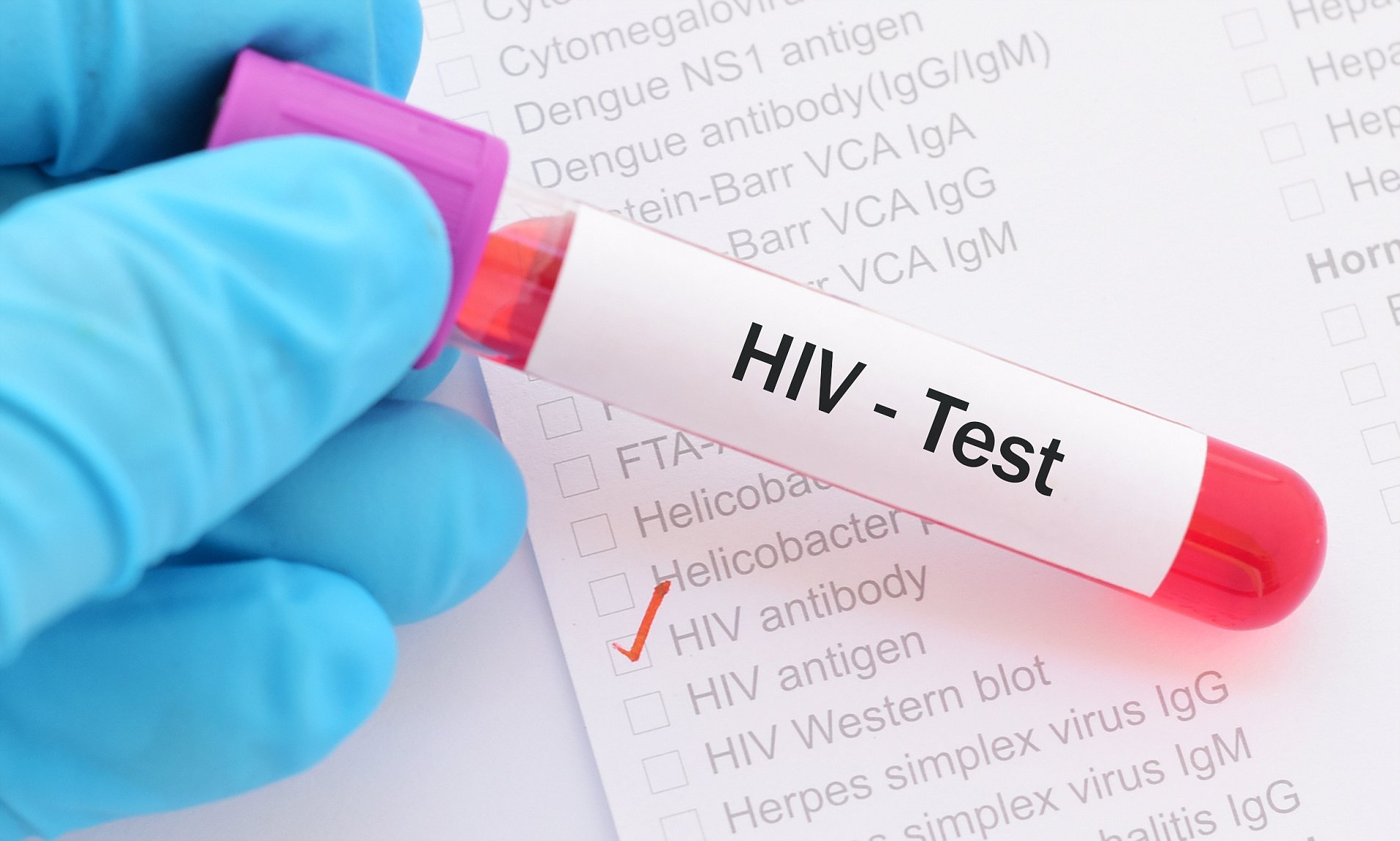 Human Immunodeficiency Virus Test