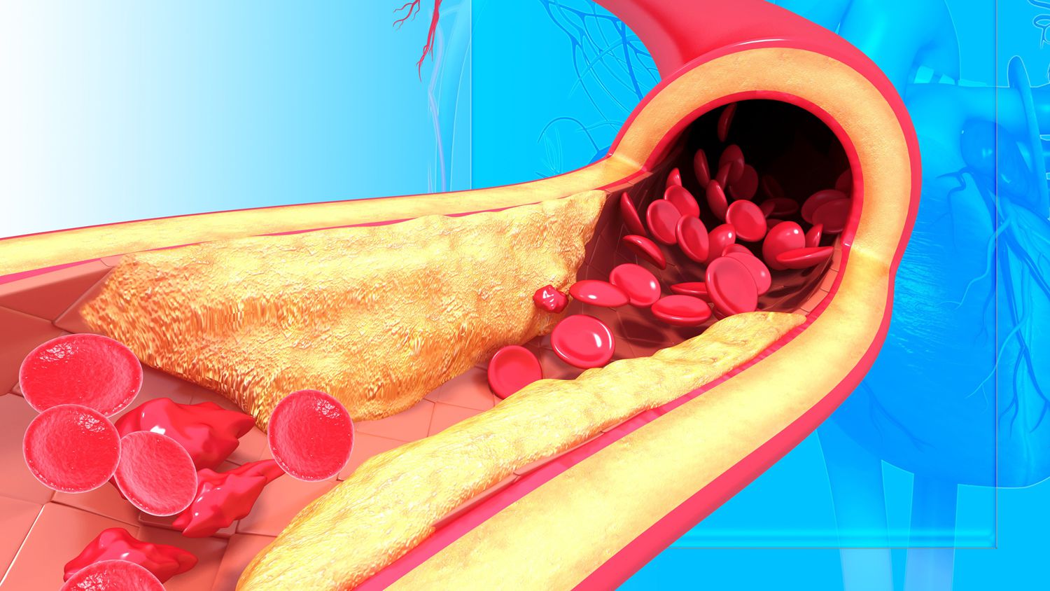 What You Need to Know About Cholesterol