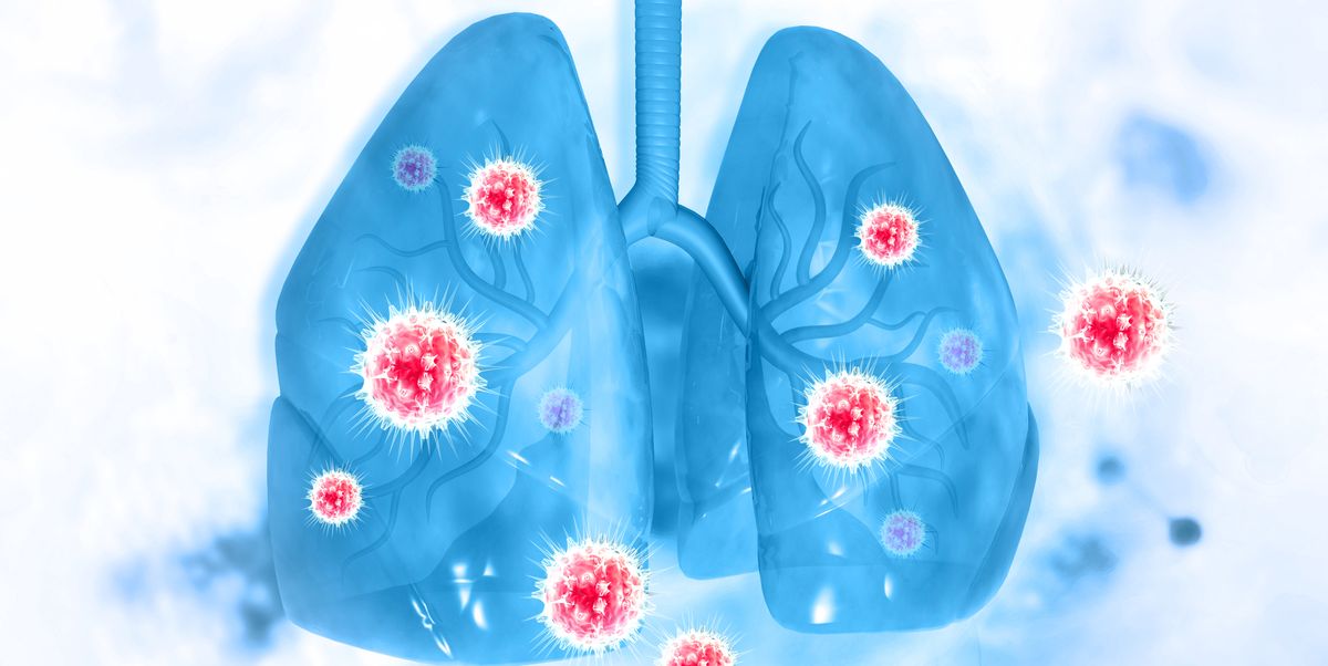 Respiratory Virus PCR Panel