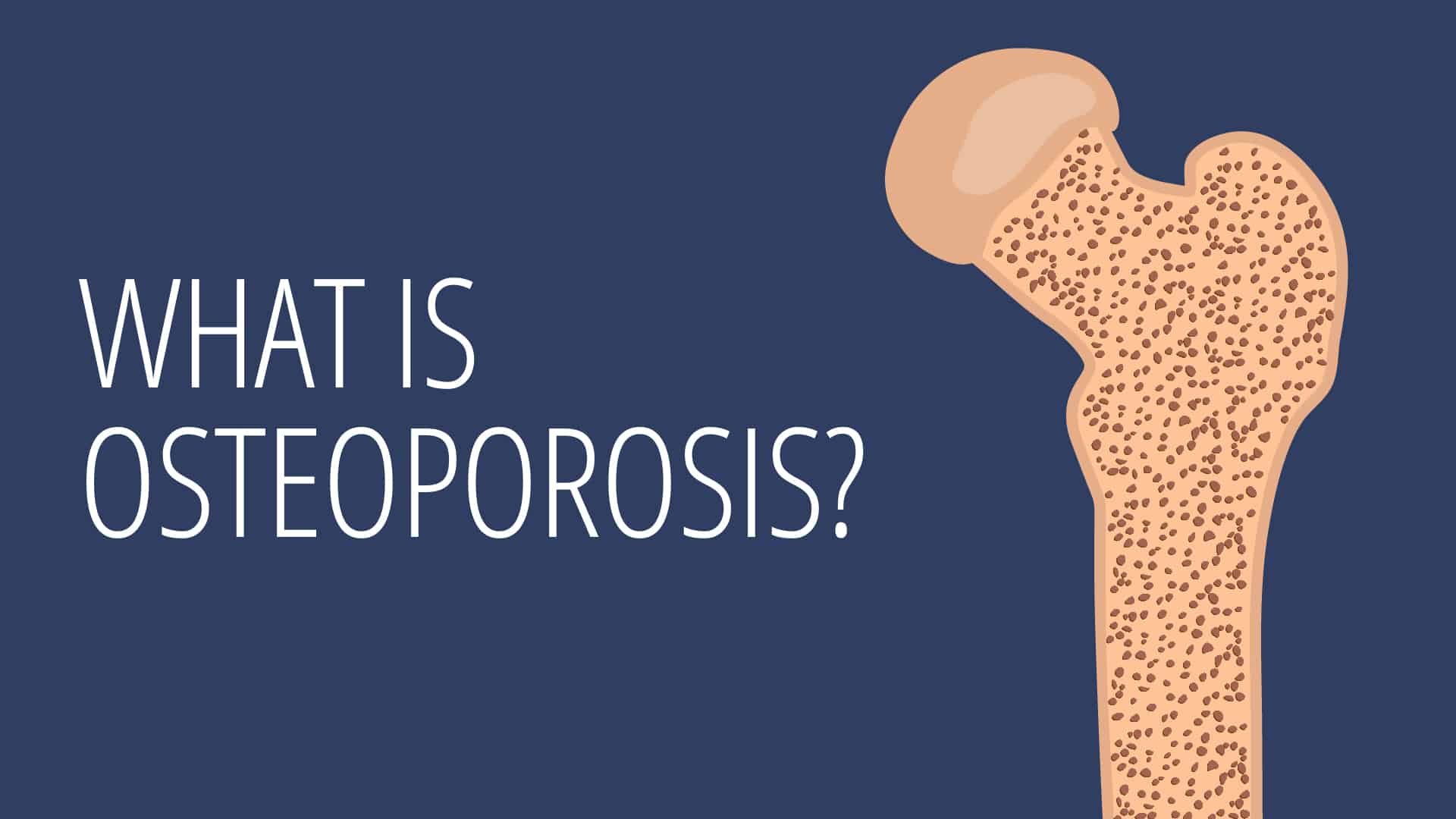 Osteoporosis